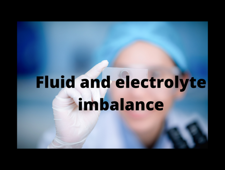 Nursing Diagnosis & Care Plan for Fluid and Electrolyte Imbalance- Student’s Guide