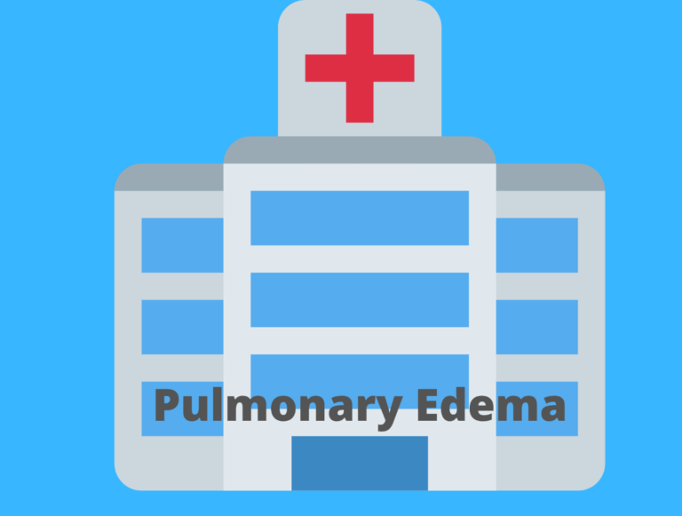 Nursing Diagnosis, Care Plan, and Interventions for Pulmonary Edema-A Student’s Guide