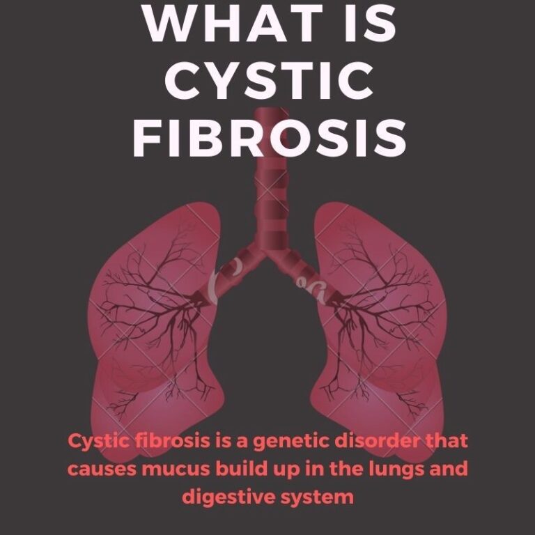 Nursing Diagnosis for Cystic Fibrosis- A Student’s Guide